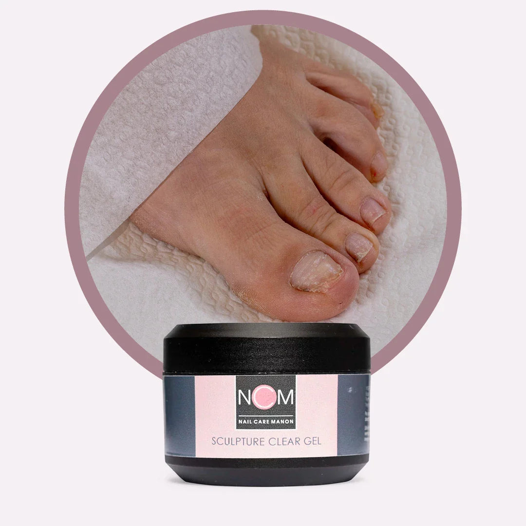 Webinar Sculpture Gel bij Stootnagels en Onycholysis Nagels