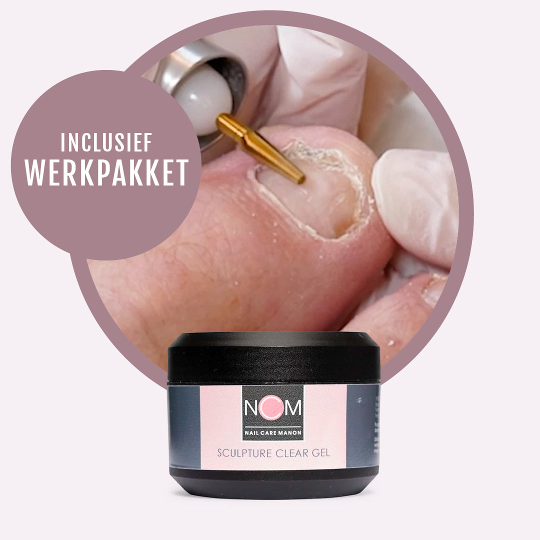 メンテナンス Multi 06A Neo Mica Base 3YG 200G FYSIEKE TRAINING: Sculpture Gel bij Mycose Nagels inclusief